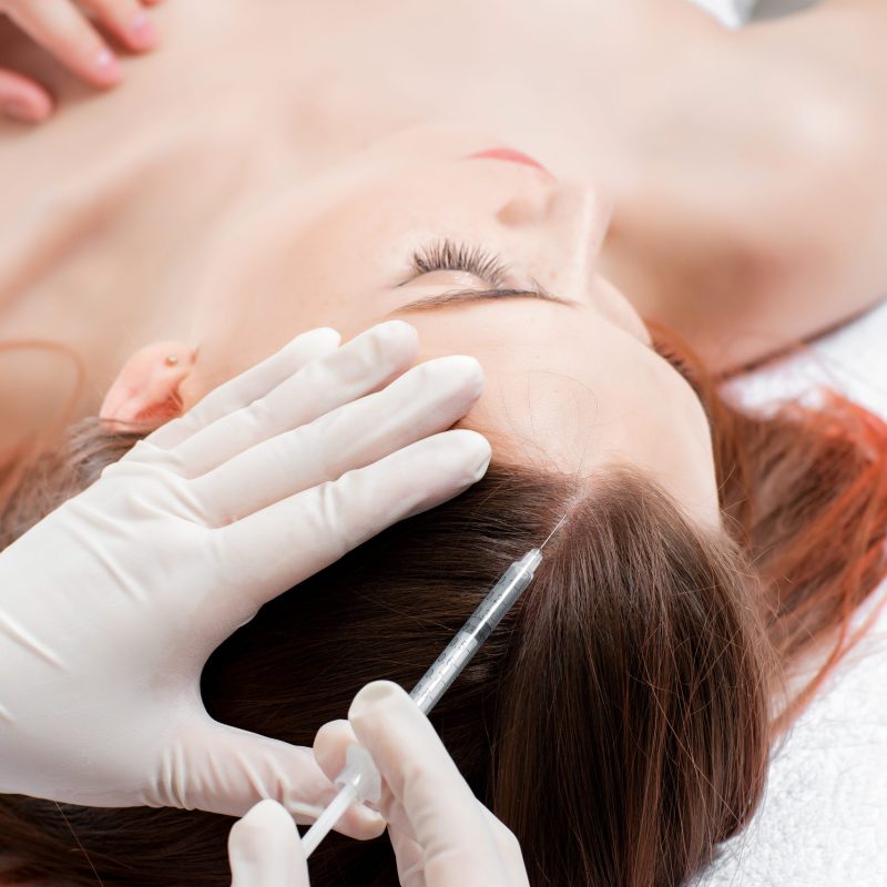 Needle mesotherapy. cosmetologist makes injections in woman head. strengthen the hair and their growth