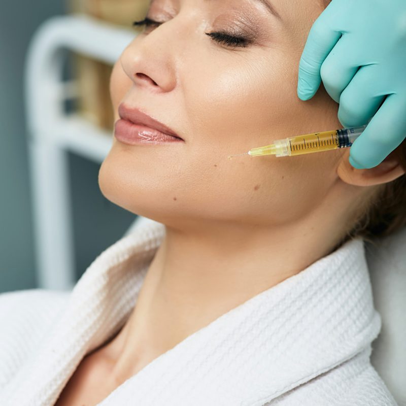 Adult woman while face plasmolifting at a beauty clinic. Cosmetology procedure for anti-aging effect on face skin