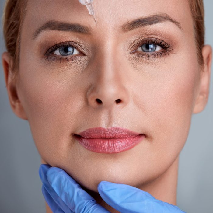 benefits of botulinum toxin